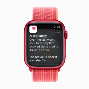 Apple watch